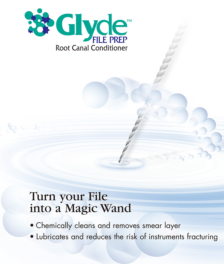 Glyde File Prep